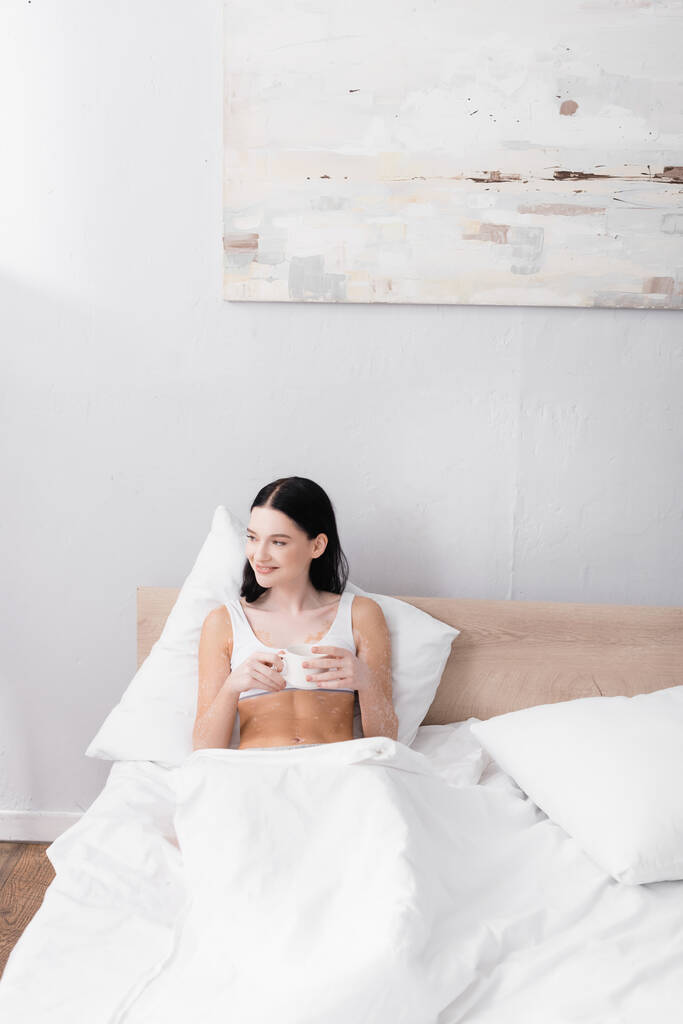 happy woman with vitiligo holding cup of coffee while resting in bed - Photo, Image