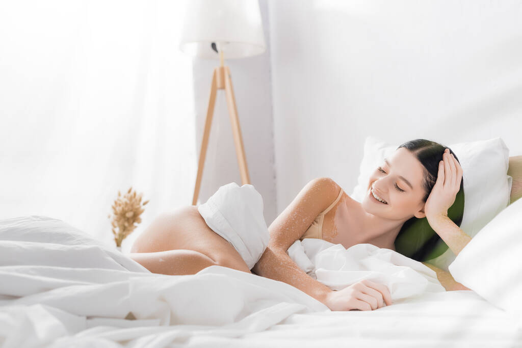 mladá šťastná žena s vitiligem ležící na posteli - Fotografie, Obrázek