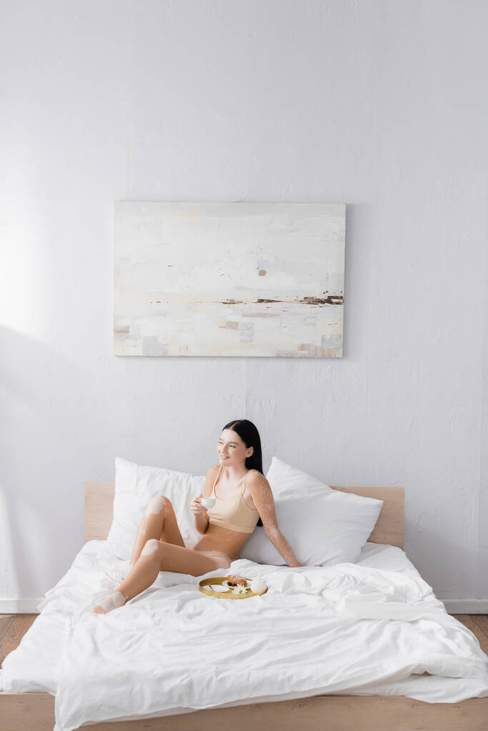 giovane donna allegra con vitiligine tenendo tazza vicino vassoio colazione sul letto - Foto, immagini