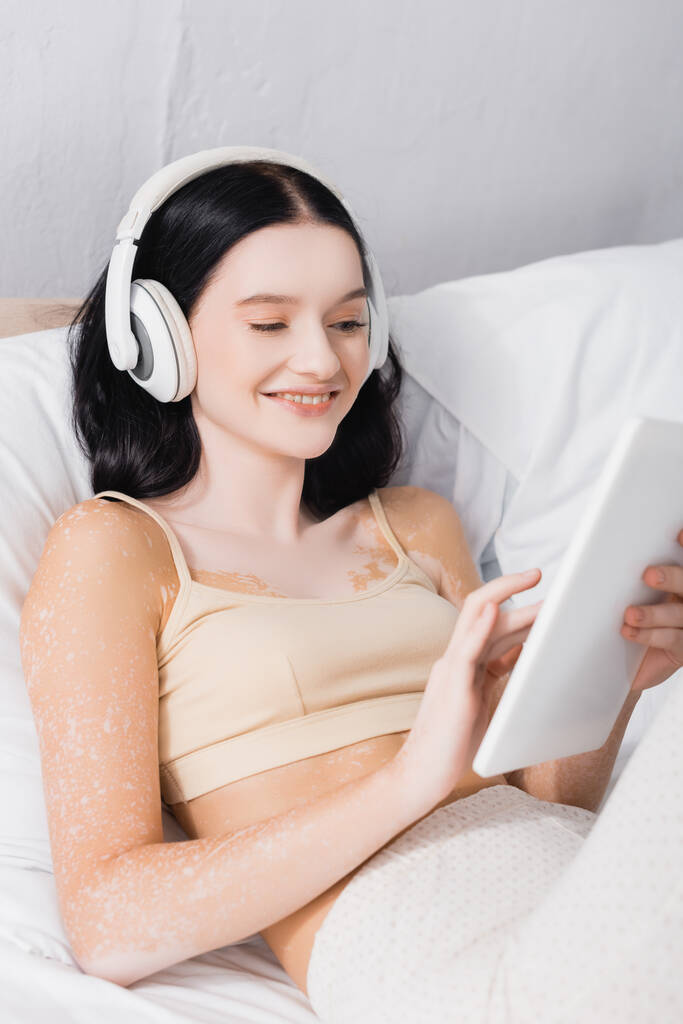 feliz joven con vitiligo en auriculares inalámbricos que sostienen la tableta digital en el dormitorio  - Foto, imagen