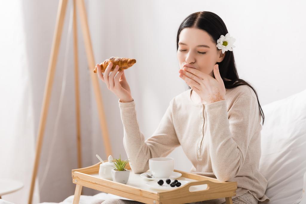 young brunette woman with vitiligo and closed eyes holding croissant near breakfast tray  - Photo, Image