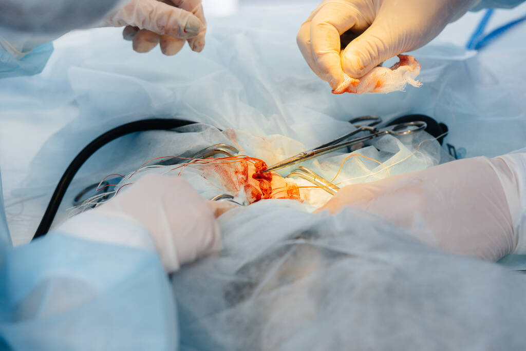 Операция в современной операционной крупным планом, экстренное спасение и реанимация пациента. Медицина и хирургия - Фото, изображение