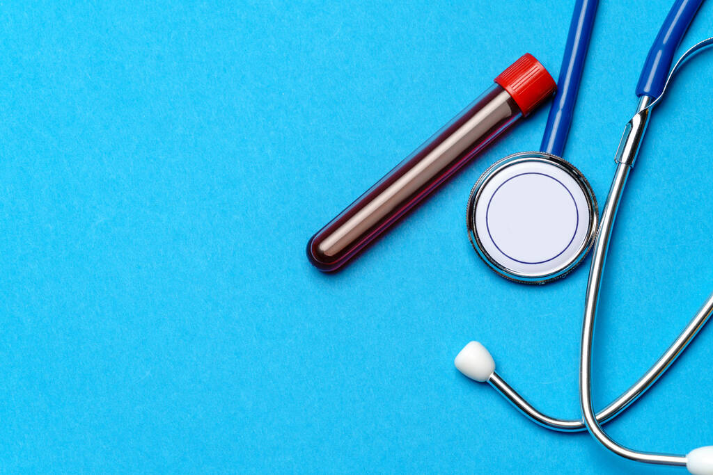 Pohled shora na lékařské vybavení na modrém pozadí - stetoskop a zkumavka - koncept zdravotnictví a medicíny - Fotografie, Obrázek