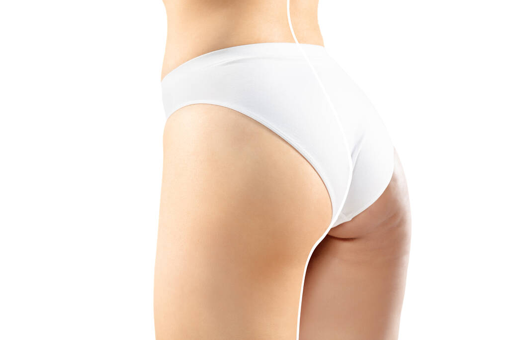 Надмірна вага жінки з жирними целюлітними ногами і сідницями, ожиріння жіночого тіла в білій білизні в порівнянні з посадкою і тонким тілом ізольовані на білому тлі
 - Фото, зображення