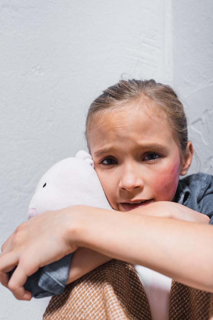 Frightened victim of domestic violence with bruise on cheek hugging soft toy  - Photo, Image