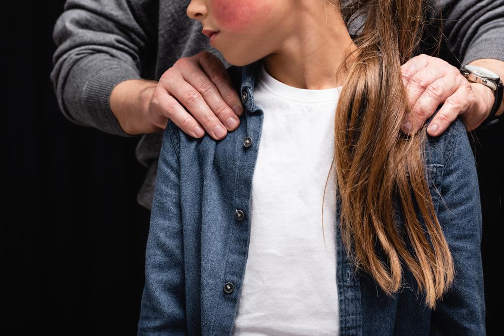 Gevoeld beeld van vader omhelzing dochter met blauwe plekken geïsoleerd op zwart  - Foto, afbeelding