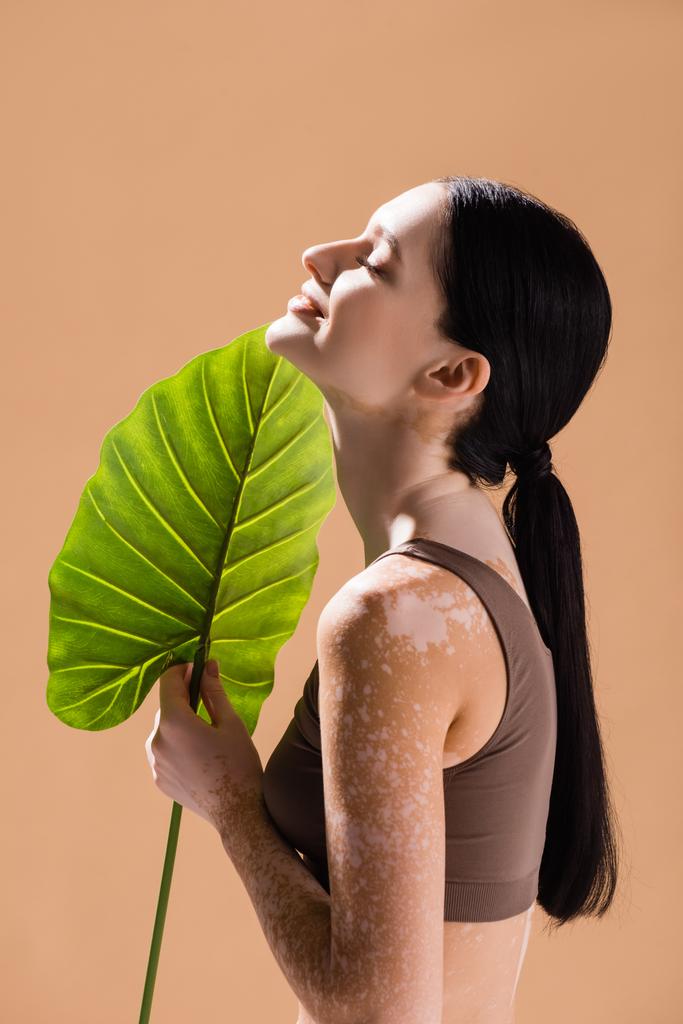 Gülümseyen, vitiligolu, yeşil yapraklı, bej renkli bir kadının yan görüntüsü. - Fotoğraf, Görsel