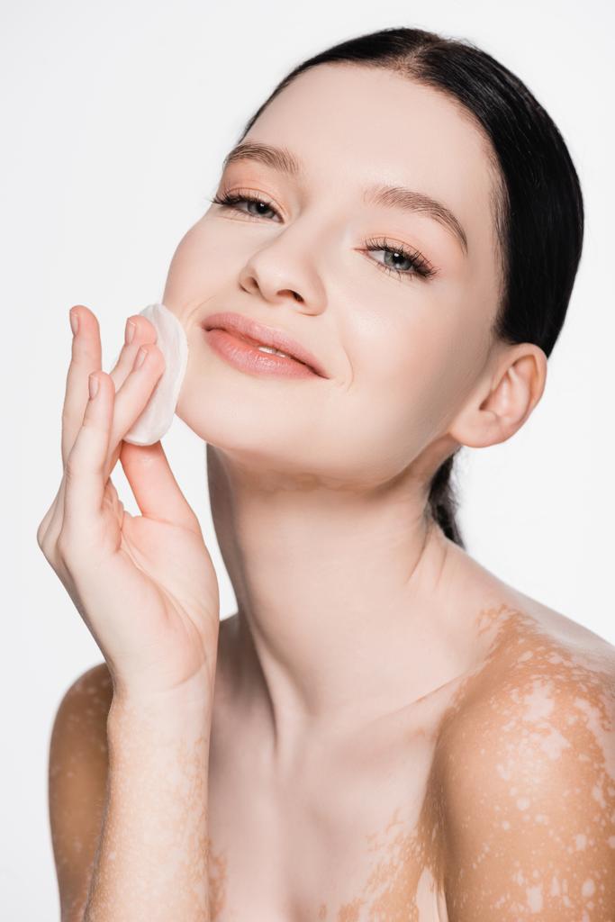 usmívající se mladá krásná žena s vitiligo čištění obličeje s bavlněnou podložkou izolované na bílé - Fotografie, Obrázek