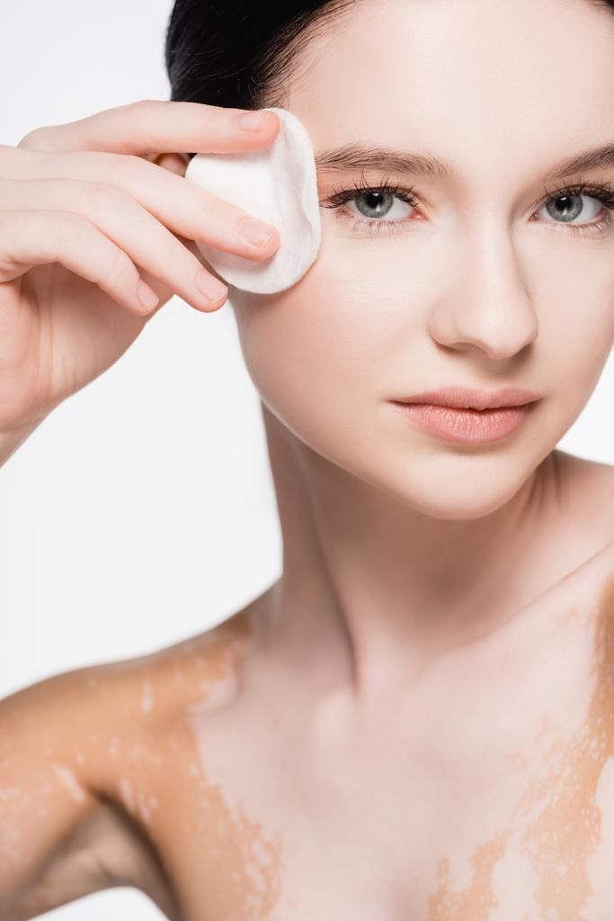 молода красива жінка з вітіліго очищає обличчя бавовняною прокладкою ізольована на білому
 - Фото, зображення