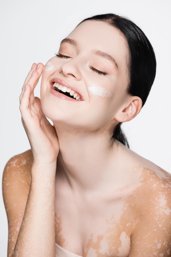sonriente joven hermosa mujer con vitiligo y crema facial en las mejillas aisladas en blanco - Foto, Imagen