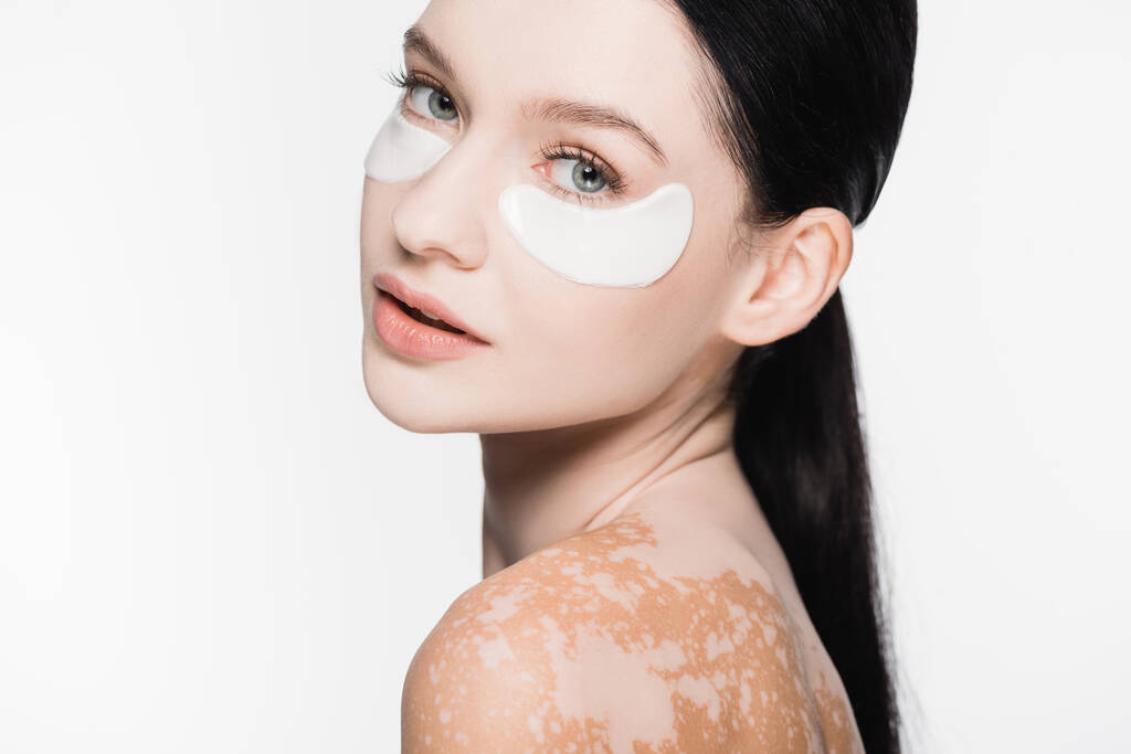 junge schöne Frau mit Vitiligo und Augenflecken im Gesicht isoliert auf weiß - Foto, Bild