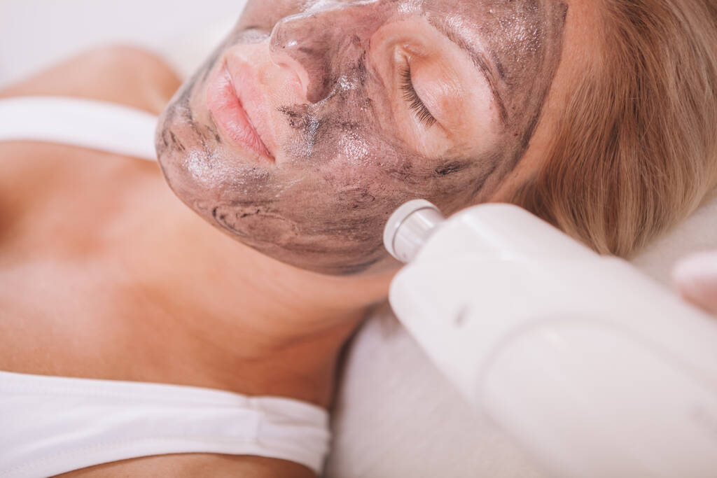 Zbliżenie kobiety leczonej laserowo łuskami węglowymi przez kosmetologa w klinice kosmetycznej - Zdjęcie, obraz