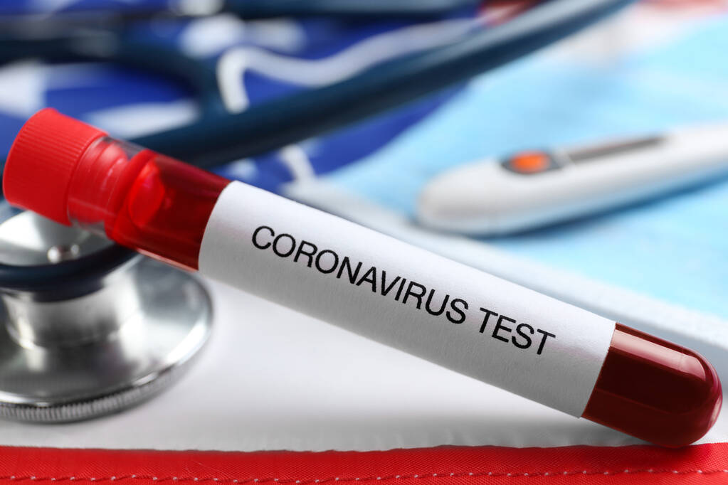 Üzerinde kan örneği olan test tüpü ve Amerikan bayrağında steteskop, yakın plan. ABD 'de koronavirüs salgını - Fotoğraf, Görsel