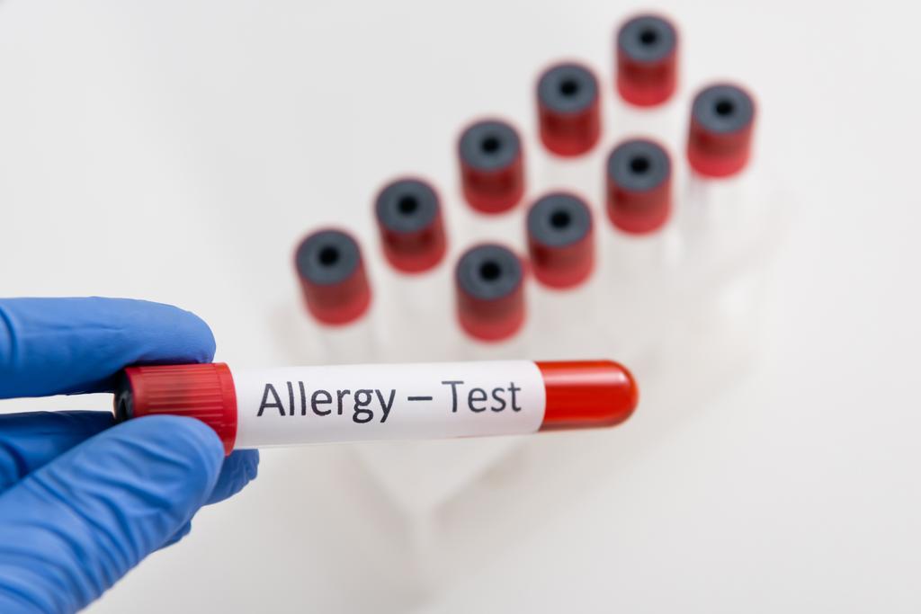 Vista recortada del médico en guante de látex sosteniendo tubo de prueba con letras de prueba de alergia  - Foto, Imagen