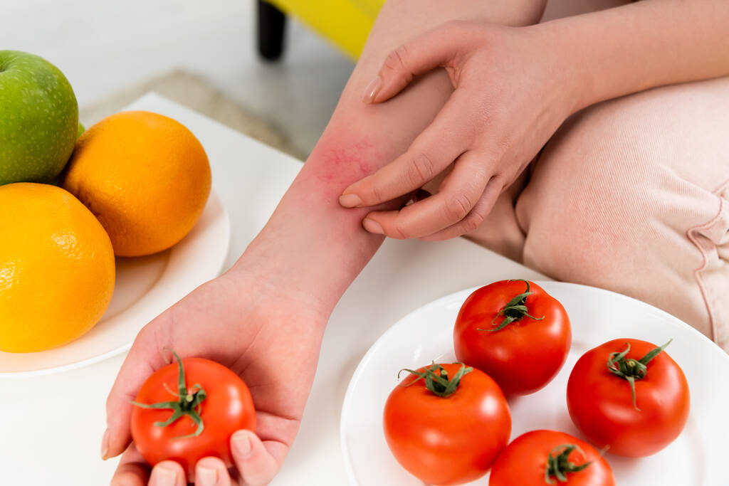 Gedeelte van een vrouw met een allergische reactie die tomaat in de buurt van vers fruit houdt  - Foto, afbeelding