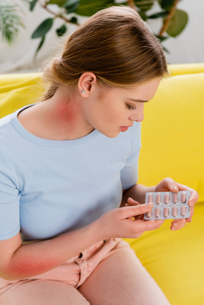 Mulher com reação alérgica no pescoço segurando blister com pílulas  - Foto, Imagem