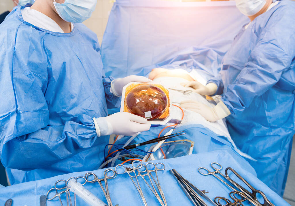 Chirurg in operatiekamer houdt steriel siliconen implantaat in handen. - Foto, afbeelding