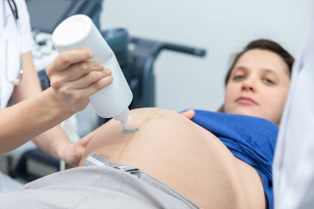 Hemşire hamile bir hastanın karnına jel sıkıyor ve ultrason için hazırlanıyor. Jinekoloji ofisi.. - Fotoğraf, Görsel
