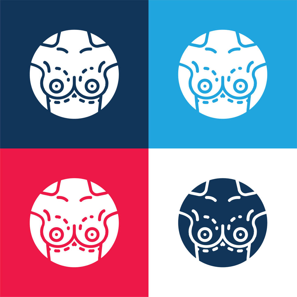 Breast Implant blue and red four color minimal icon set - Vector, Image