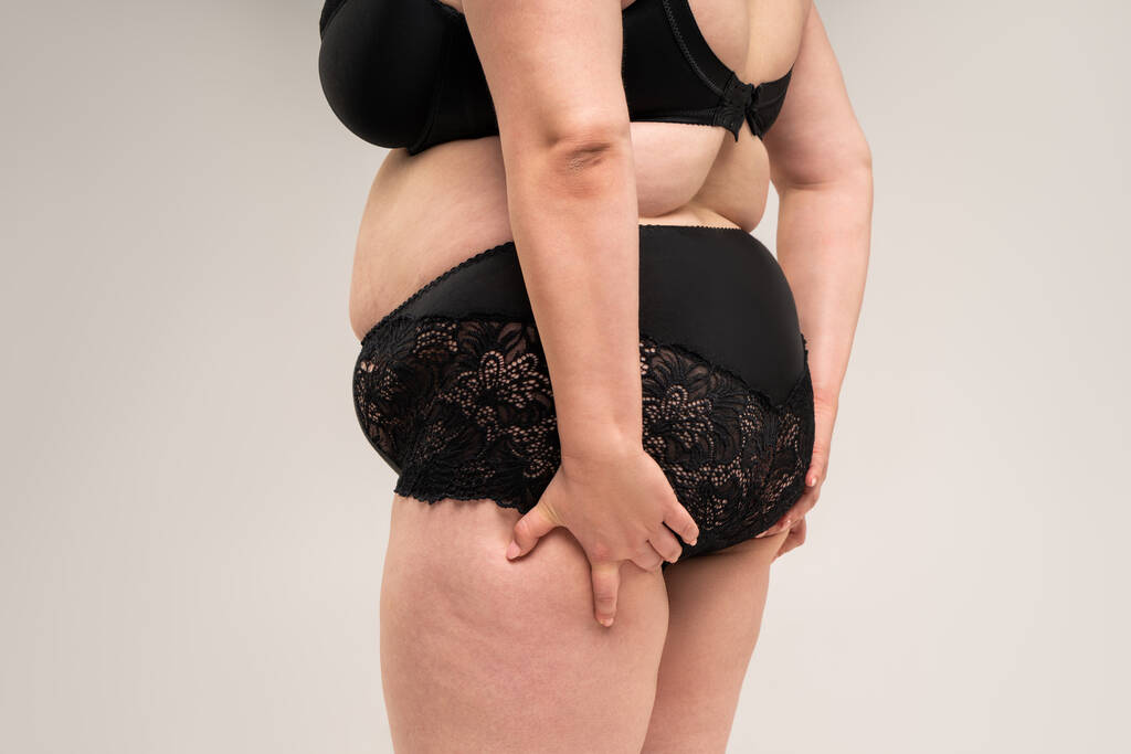 Mujer con sobrepeso, caderas y nalgas gordas, cuerpo femenino con obesidad sobre fondo gris, toma de estudio - Foto, imagen