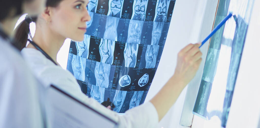 Twee vrouwelijke artsen wijzend op röntgenstralen in een ziekenhuis - Foto, afbeelding