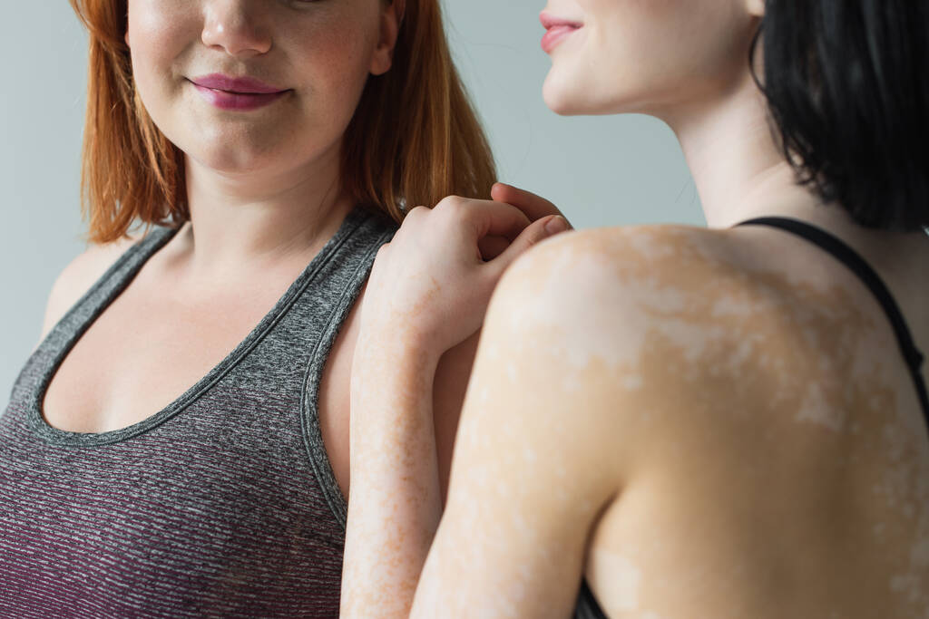 Oříznutý pohled na sportovkyně s vitiligo objímání plus velikost přítel izolované na šedé  - Fotografie, Obrázek