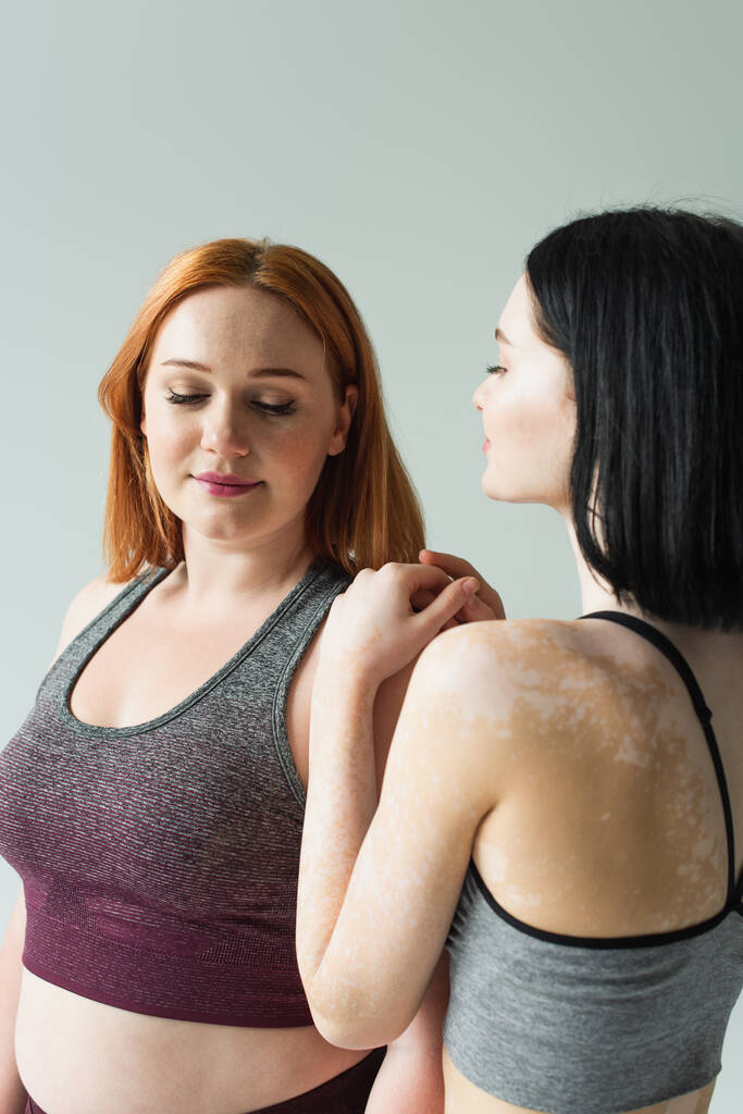 Młoda kobieta z przytulanie vitiligo plus rozmiar sportowiec odizolowany na szarości  - Zdjęcie, obraz