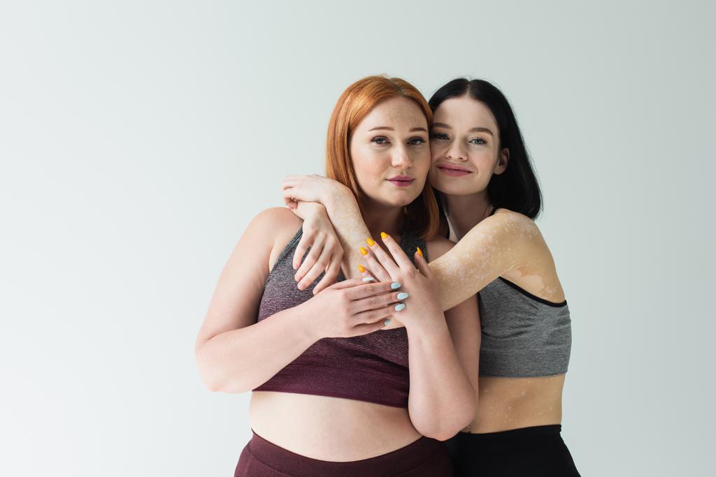 Sportswoman con vitiligine abbracciando corpo amico positivo isolato su grigio  - Foto, immagini