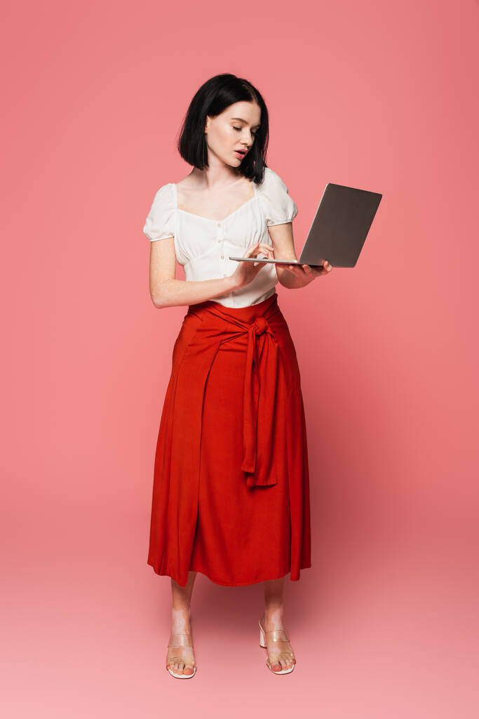 Stílusos nő vitiligo gazdaság laptop rózsaszín háttér  - Fotó, kép