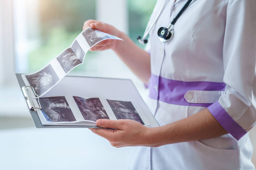 Arzt untersucht Ultraschallbilder des Patienten nach Sonographie während einer Gesundheitsprüfung und Konsultation - Foto, Bild