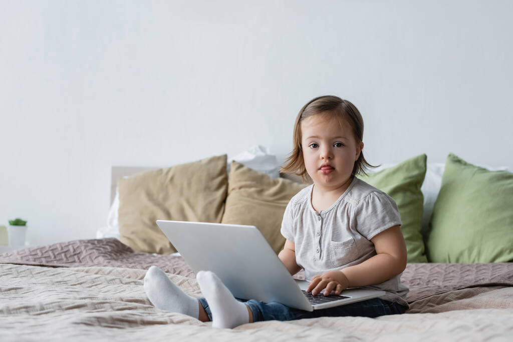 Παιδί μικρό παιδί με σύνδρομο down χρησιμοποιώντας φορητό υπολογιστή στο κρεβάτι στο σπίτι  - Φωτογραφία, εικόνα