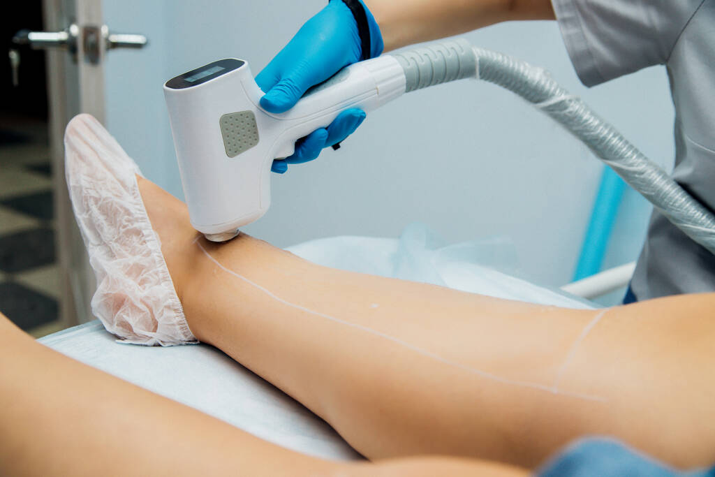 Процедура лазерной эпиляции женских ног. Применение сахарной пасты для сахарной процедуры. Уход за кожей, косметические процедуры. - Фото, изображение
