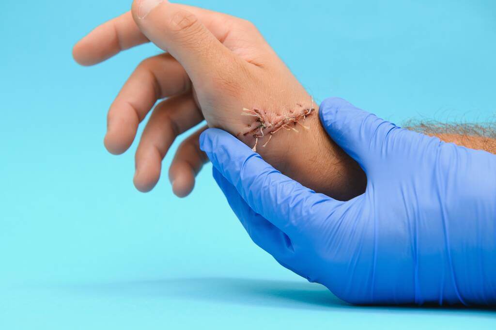 examen par un médecin d'une coupure au bras - Photo, image