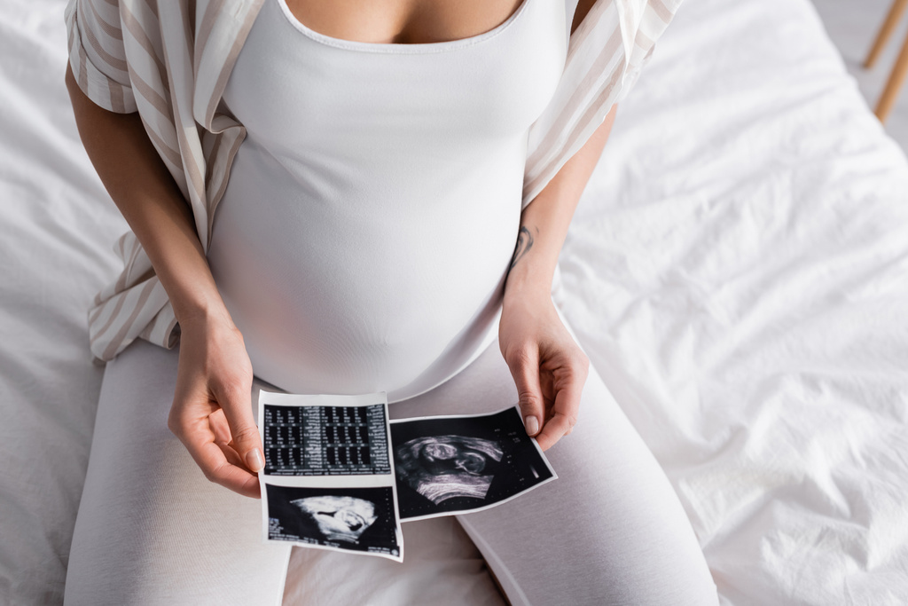 visão parcial da mulher grávida segurando imagens de ultra-som  - Foto, Imagem