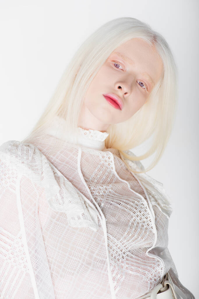 Πορτρέτο της νεαρής γυναίκας Albino κοιτάζοντας μακριά απομονωμένη σε λευκό  - Φωτογραφία, εικόνα