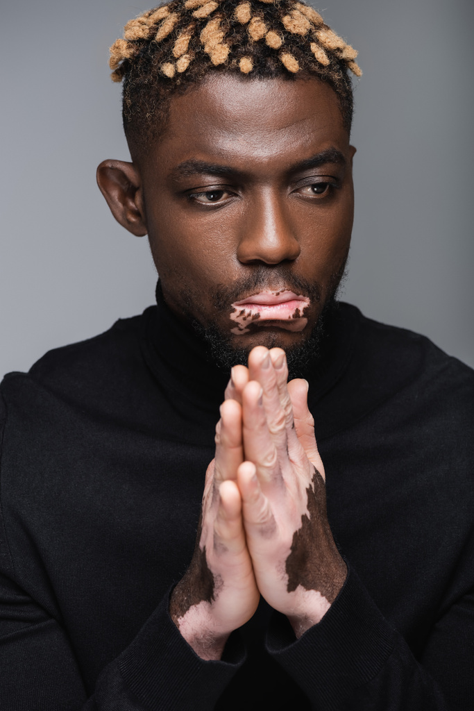stylish african american man with vitiligo skin and praying hands isolated on grey - Photo, Image