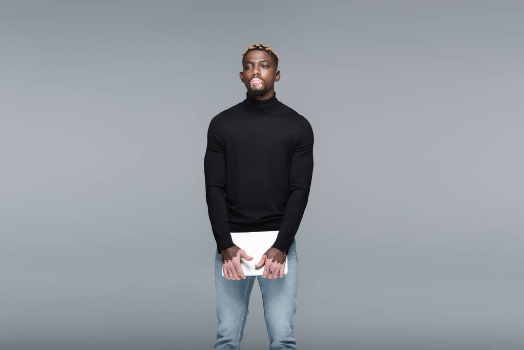 young african american man with vitiligo, in jeans and black turtleneck, standing with laptop isolated on grey - Zdjęcie, obraz