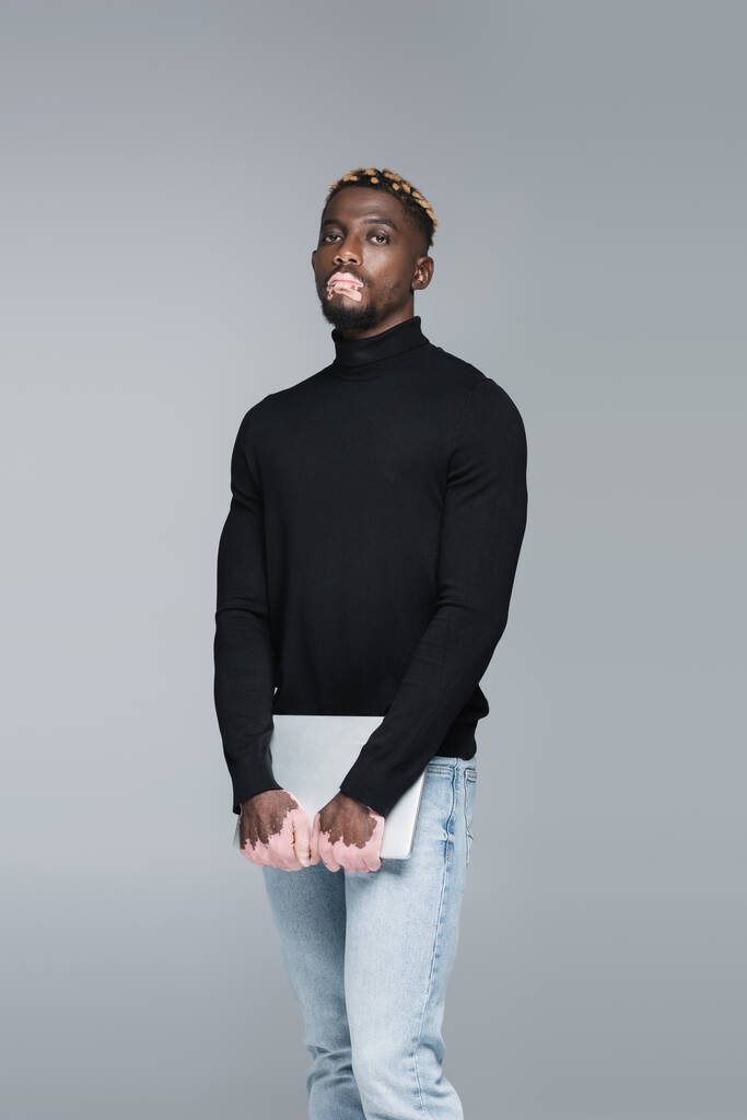 african american man with vitiligo and trendy hairstyle looking at camera while posing isolated on grey - Valokuva, kuva