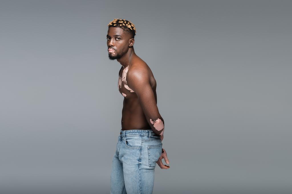shirtless african american man with vitiligo looking at camera while posing in jeans isolated on grey - Photo, Image