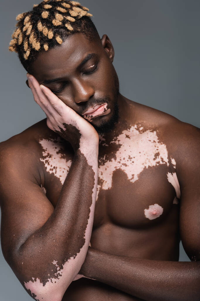 tired african american man with vitiligo and muscular torso posing with closed eyes and hand near face isolated on grey - Photo, Image