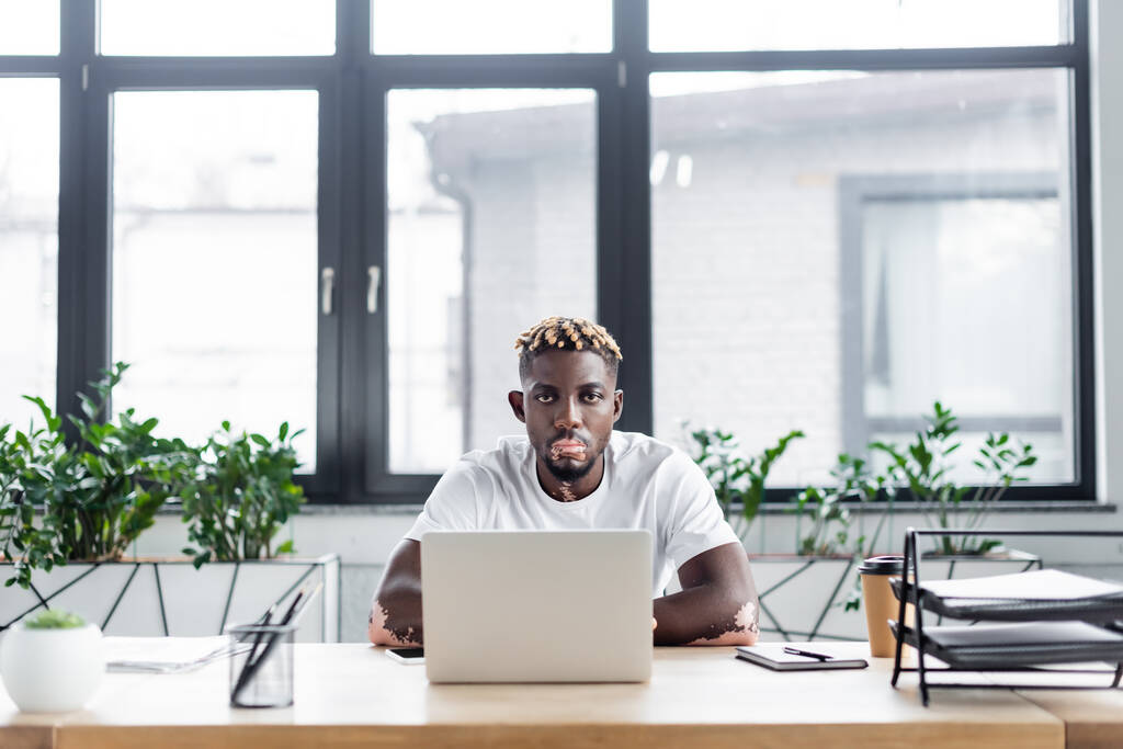 hombre afroamericano con vitiligo y peinado elegante mirando a la cámara cerca de la computadora portátil y café para ir en la oficina - Foto, imagen