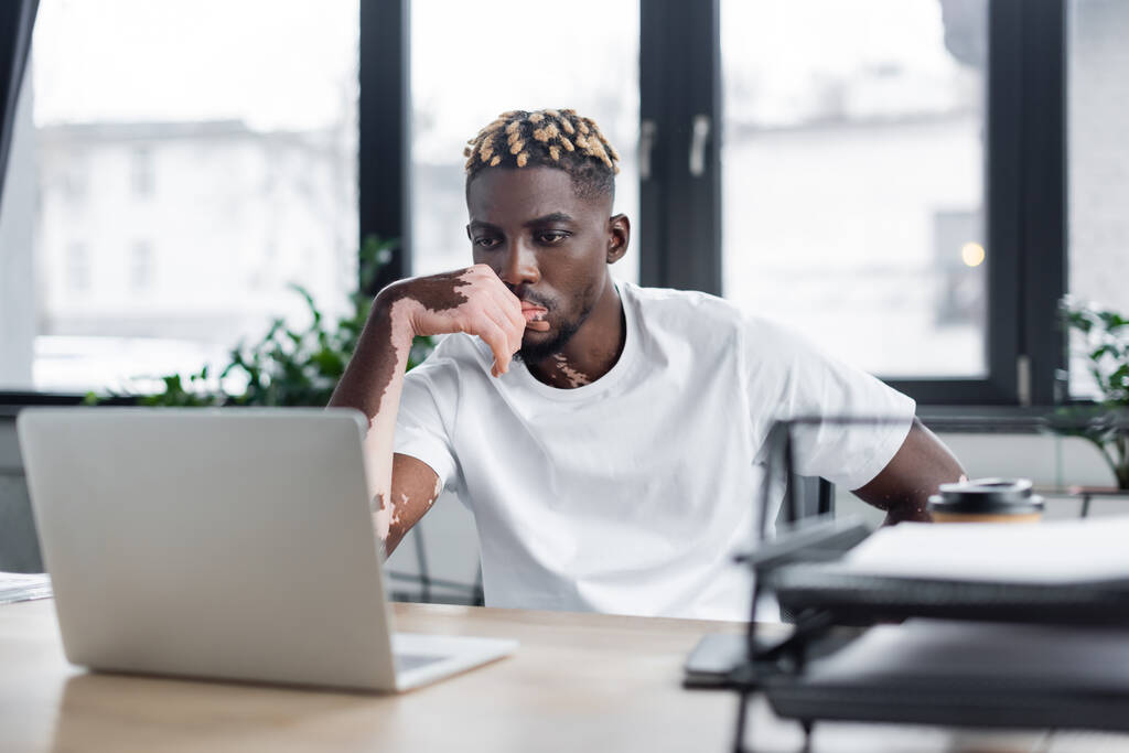 hombre afroamericano serio con vitiligo pensando cerca borrosa portátil en la oficina - Foto, imagen