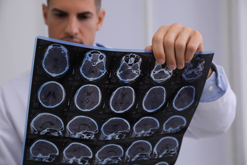 Médico examinando imágenes de resonancia magnética del paciente con esclerosis múltiple en la clínica, primer plano - Foto, Imagen