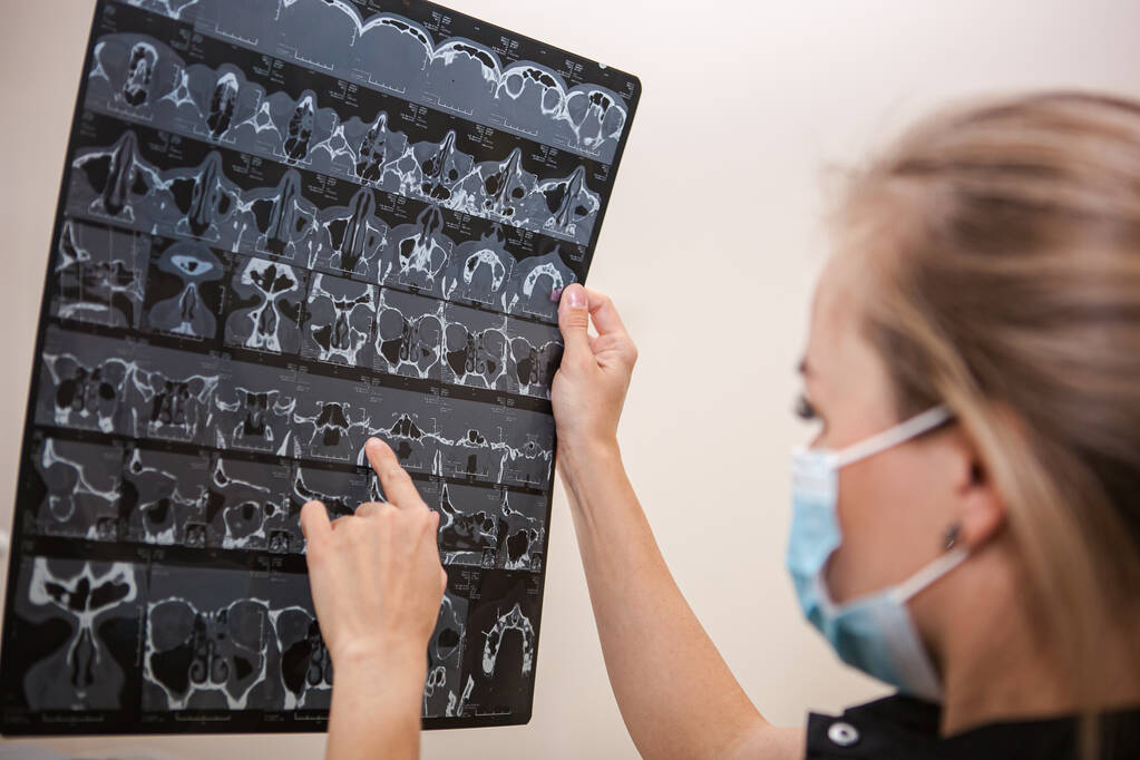  uma mulher branca médico com cabelo loiro longo em um uniforme preto detém uma ressonância magnética da cabeça em suas mãos - Foto, Imagem