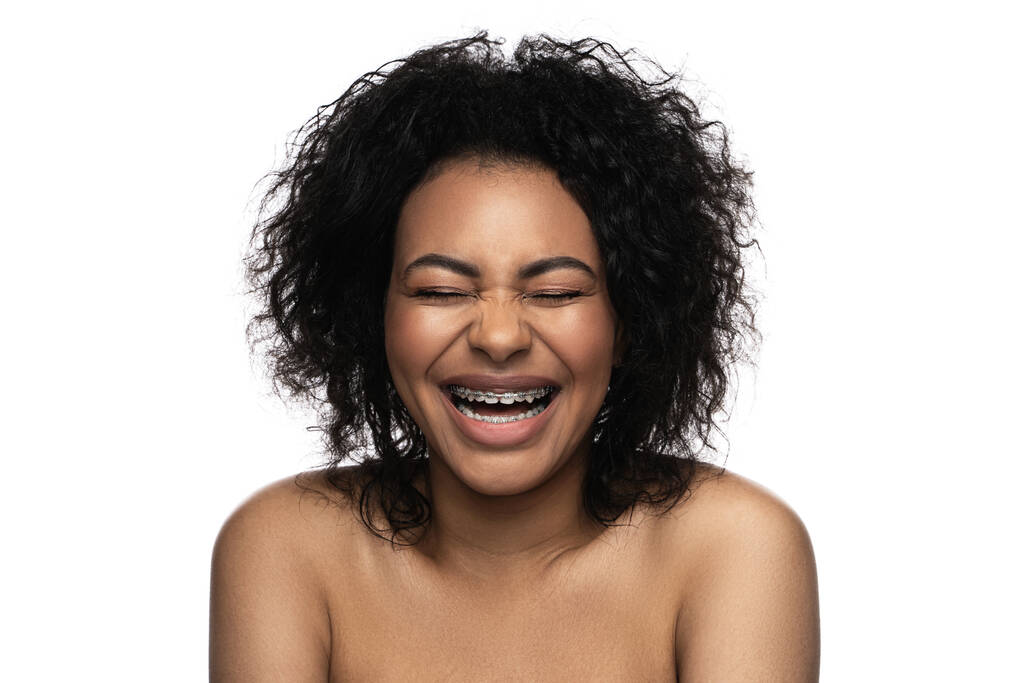 Feliz sorrindo mulher negra com um aparelho dental em seus dentes contra fundo branco - Foto, Imagem