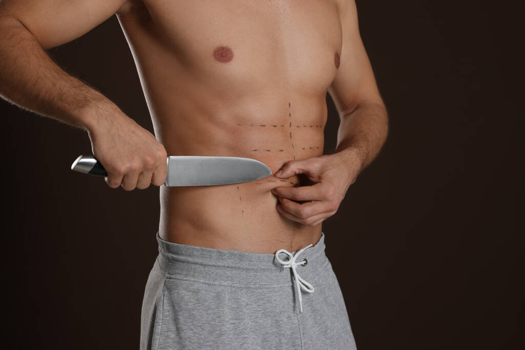 Fit man with knife and marks on body against dark brown background, closeup. Weight loss surgery - Zdjęcie, obraz