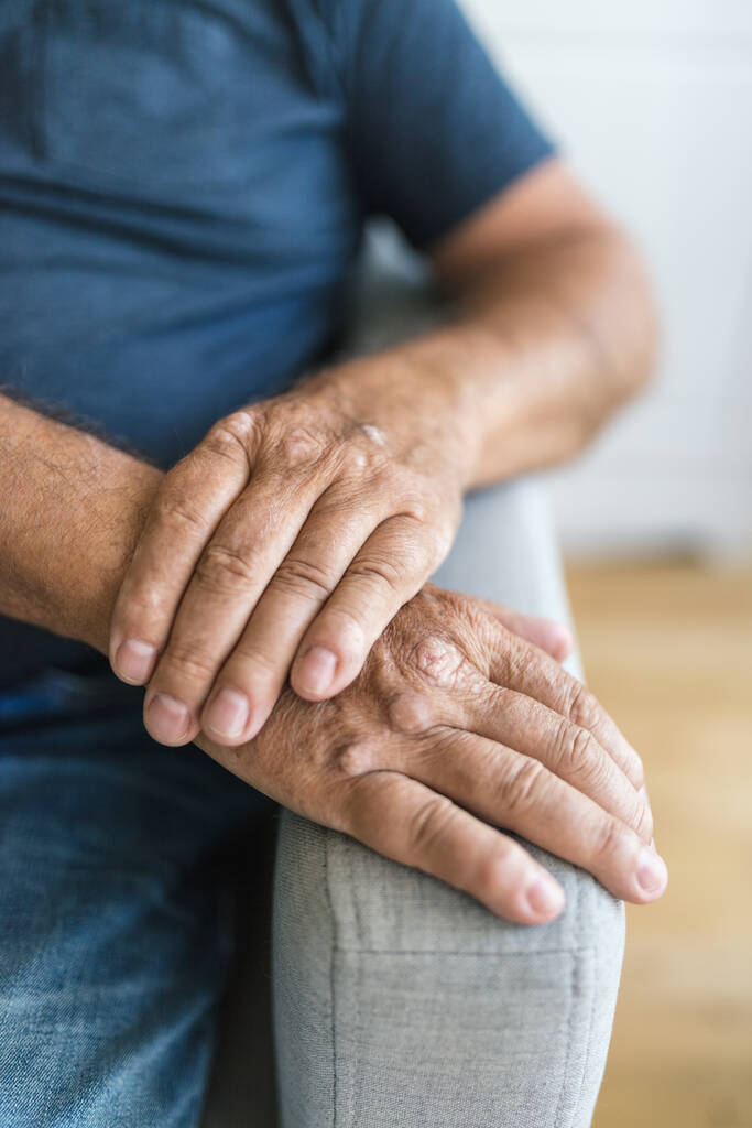 Пожилой человек, страдающий псориазом, крупный план на руках - Фото, изображение