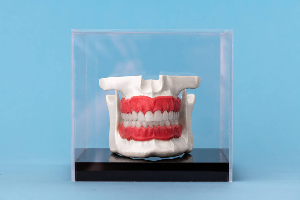 Человеческая челюсть с имплантатами зубов анатомическая модель изолирована на синем фоне в стеклянной коробке. Здоровые зубы, стоматологическая помощь и концепция ортодонтического медицинского здравоохранения. Космическая фотография в высоком качестве.  - Фото, изображение