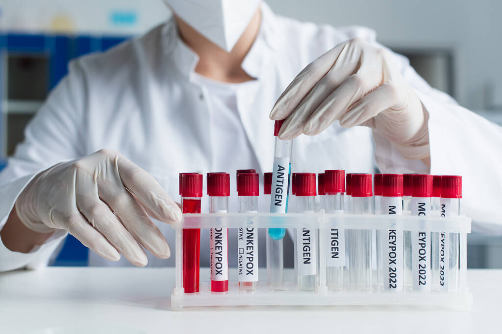 Обрезанный вид ученого в латексных перчатках, принимающего пробирку с антигеновыми надписями в лаборатории  - Фото, изображение