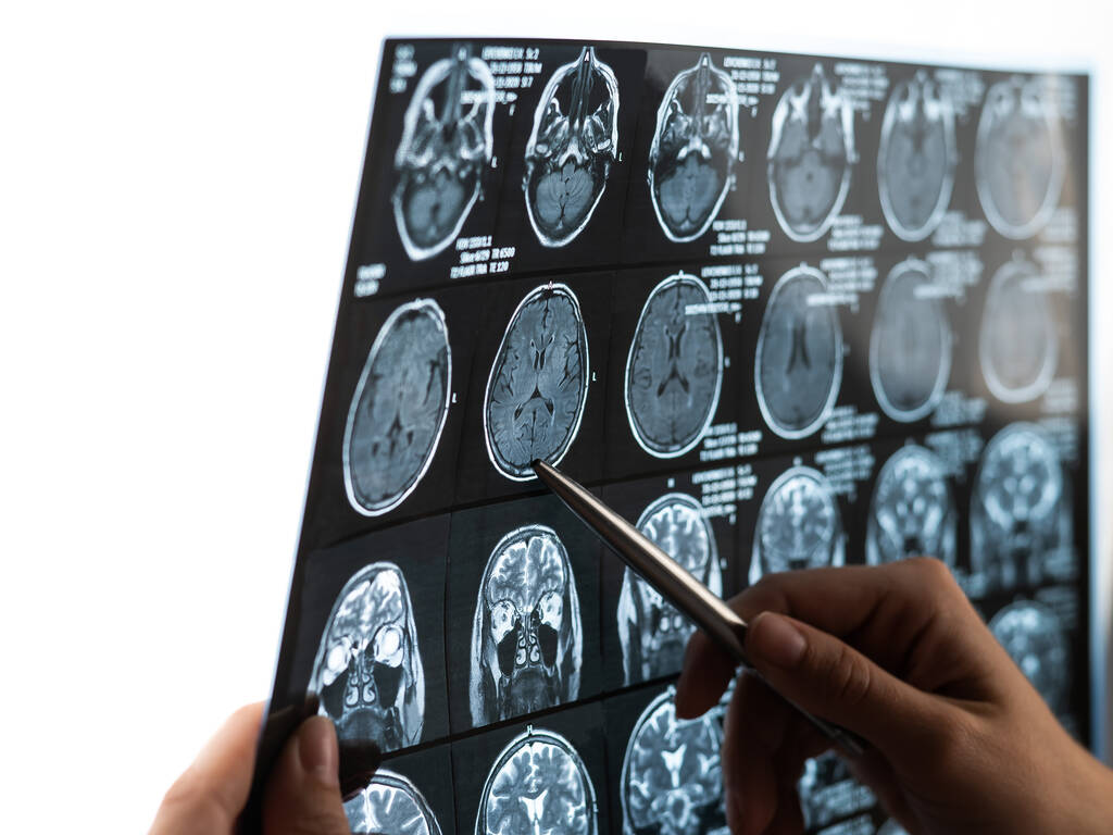 Μια γυναίκα γιατρός εξετάζει μια μαγνητική τομογραφία του εγκεφάλου - Φωτογραφία, εικόνα